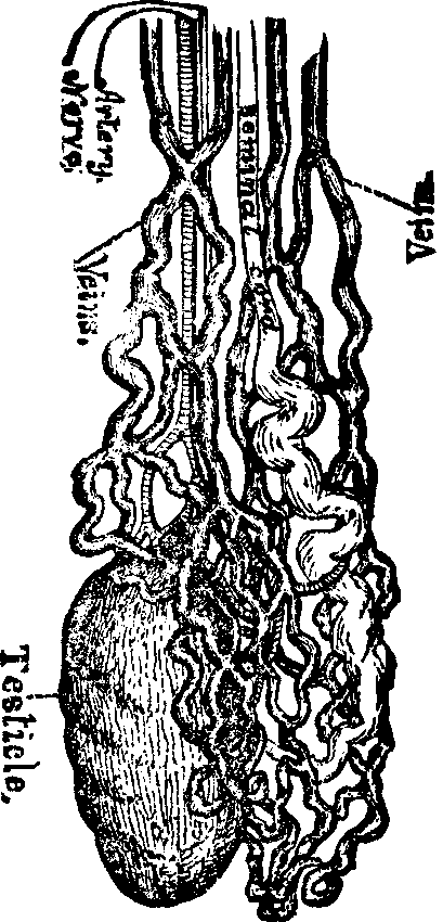 Illustration:
Fig. 2. A Testicle wasted by Masturbation.