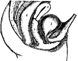 Contents of the Female Pelvis