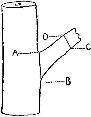 When a broken stump, such as is
here shown, has to be sawn off, the
proper place to amputate it is from A
to B; the wrong place from C to D.