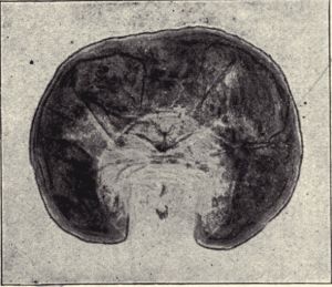 The female red orange scale.