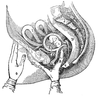 mode of
performing the Ballotment