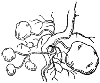 FIG. 8.—TUBERS OF THE COMMON POTATO

Potatoes are swollen portions of rootstock.