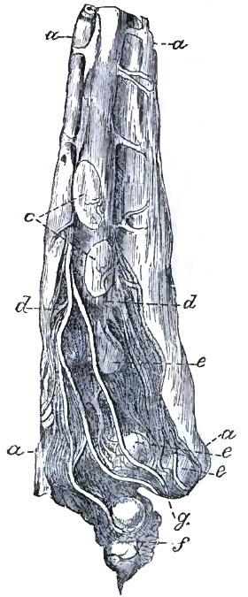 Tumor of cauda equina