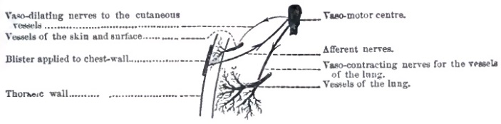 Action of counter-irritants to chest