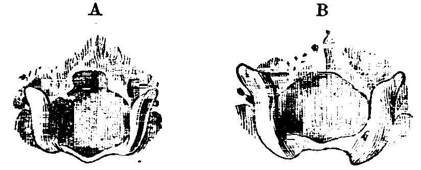Fig. 10.--Occipital Foramina of rabbits.