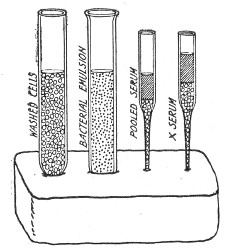 Fig. 194.—Plasticine block with materials arranged for
opsonin estimations.