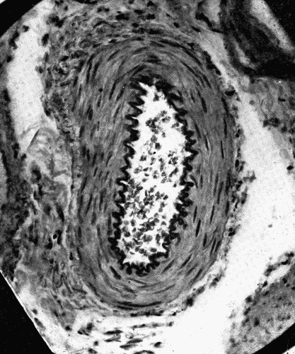 Fig. 10.—Cross-section of a small artery in the mesentery. Note that the vessel appears
capable of being much widened. The internal elastic lamina is thrown into folds
somewhat resembling the convolutions of the brain. Note also that the middle coat
of the artery is composed almost entirely of muscle. The enormous number of such
vessels in the mesentery and intestines explains the ability of the splanchnic area to
accommodate the greater part of the blood in the body. Universal constriction of these
vessels would naturally render the intestines anemic. The vasomotor control of these
vessels plays an important rle in the distribution of the blood. Small arteries in the
skin and in other organs, possibly the brain, have a similar function. (Microphotograph,
highly magnified".)