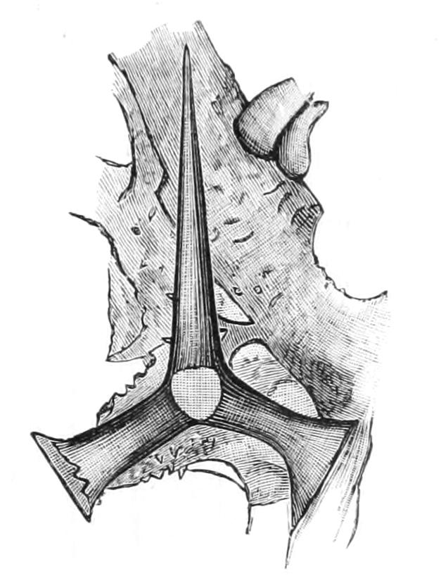 fig87